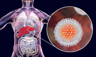 Día Mundial contra la Hepatitis
